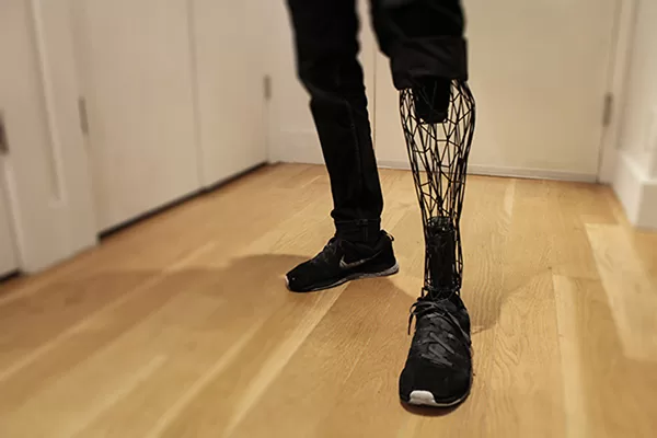 3D printed exo prosthetic leg